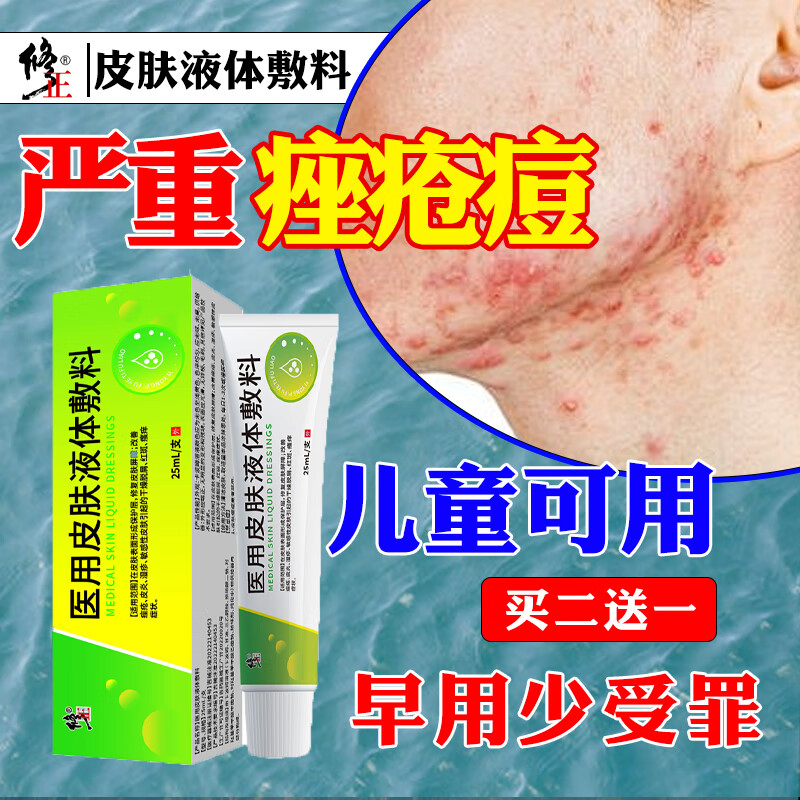 修正祛痘消i炎痤疮专用膏脓疱疮毛囊炎玫瑰痤疮脸上痘痘皮肤用药 单