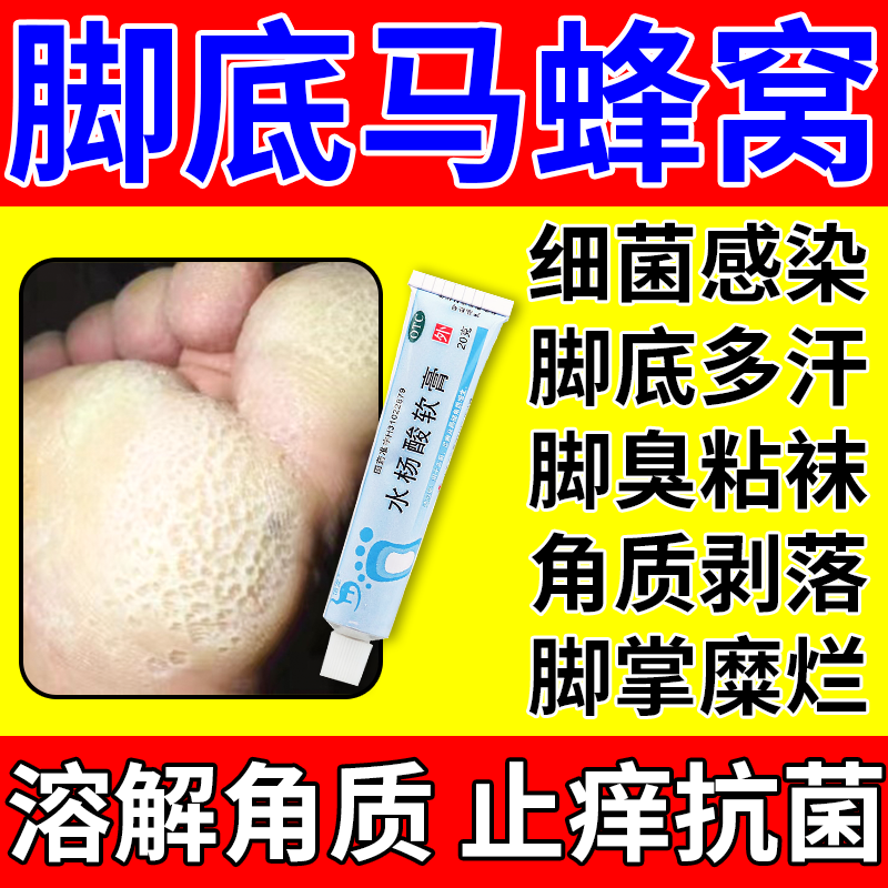 窝状角质松懈症专用药脚底蜂窝状发白沙虫脚气脚臭脚出汗烂脚丫脱皮