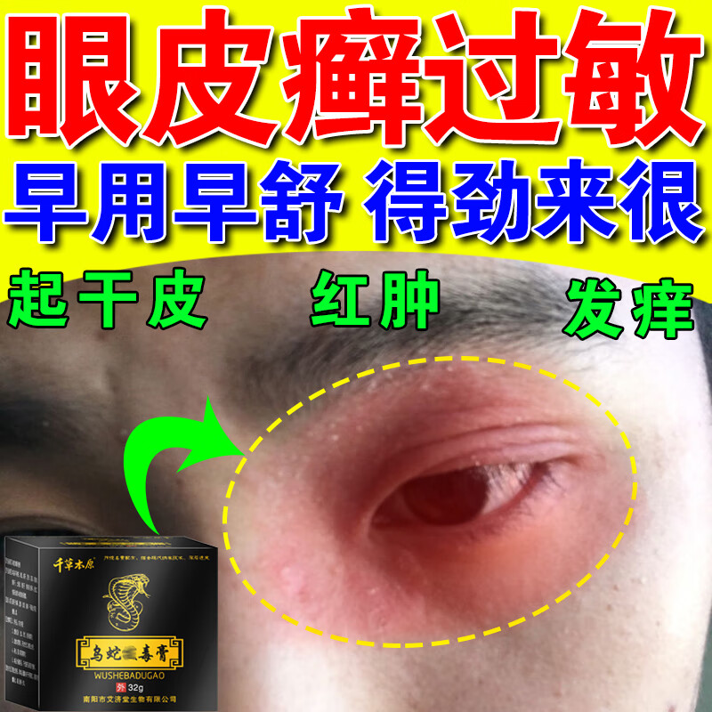 皮肤干燥起皮眼皮癣红肿痒过敏干燥起皮干皮眼睛周围过敏保湿修复霜