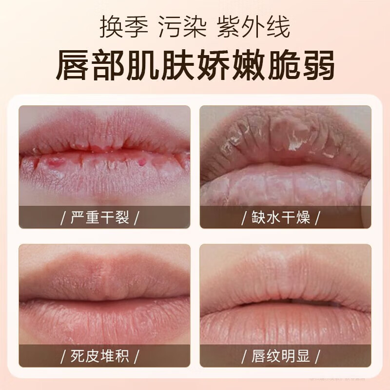 DHCR+润唇膏橄榄护唇膏女士嘴唇干裂脱皮起皮男女学生 1支装