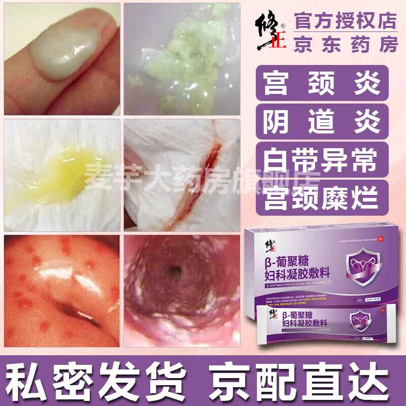 修正医用妇科凝胶治疗细菌霉菌私密阴道炎宫颈炎阴部瘙痒糜烂疼痛白带异常异味私处抑菌凝胶妇科炎症女性药 妇科私处凝胶【1盒】