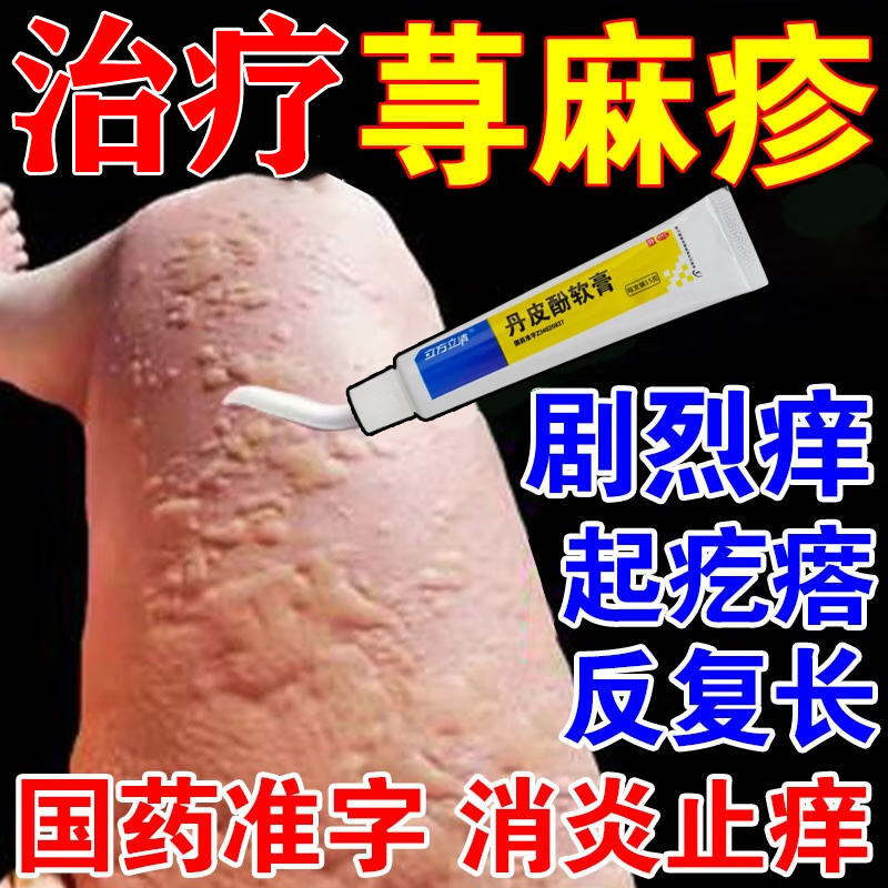 配六个草用治疗荨麻疹过敏止痒根难断荨麻疹【成人专用】金方舒爽膏i