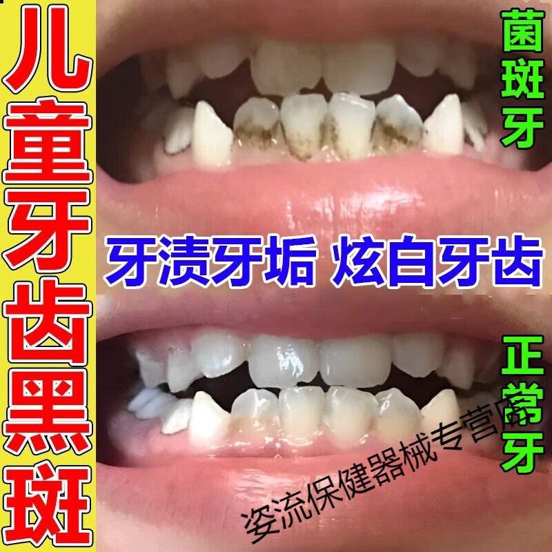 牙菌斑去除儿童牙齿炫白神器牙垢牙渍口腔异味牙齿黑斑益生菌牙膏 单