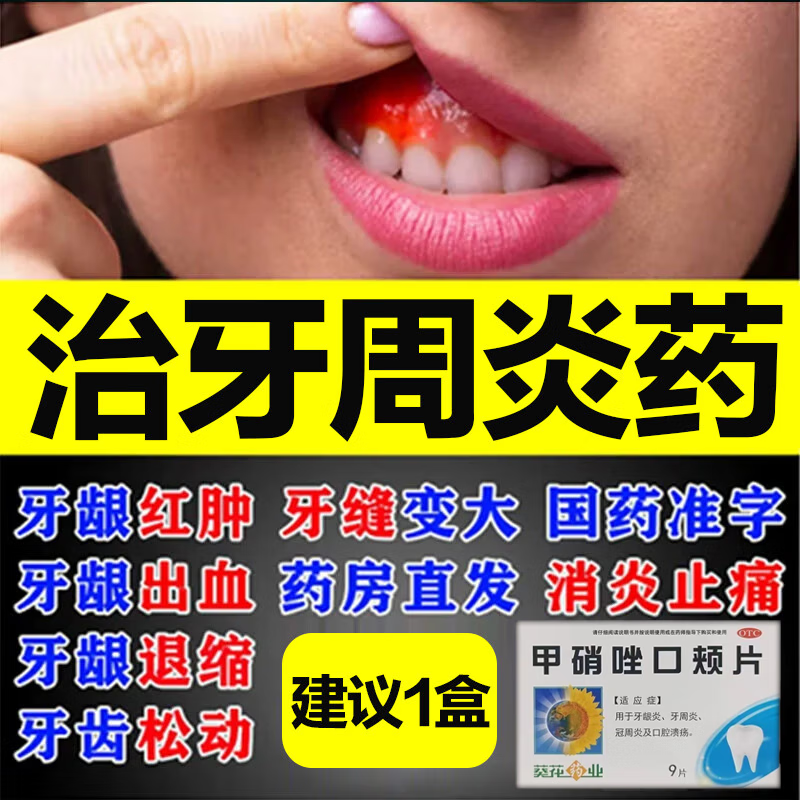 牙周炎专用药 牙齿松动 牙龈萎缩牙疼消炎药牙痛药止疼止痛牙龈肿痛可