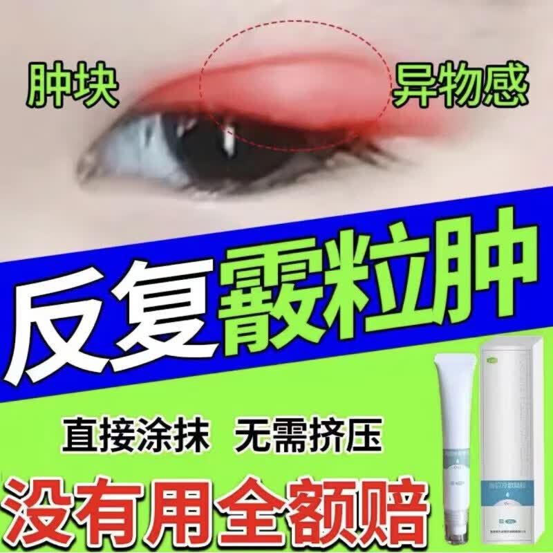 眼睑炎红肿 【发新包装】3盒【疗程装】
