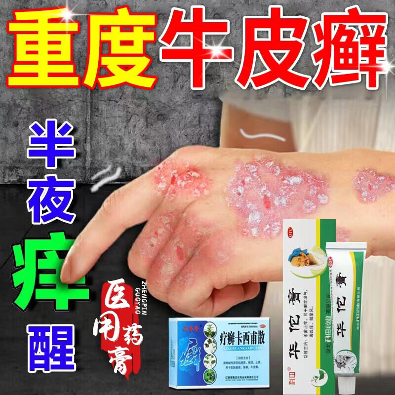 真菌止痒 抑菌 皮肤 顽固牛皮癣银屑病 皮肤瘙痒止痒 华佗膏【主图