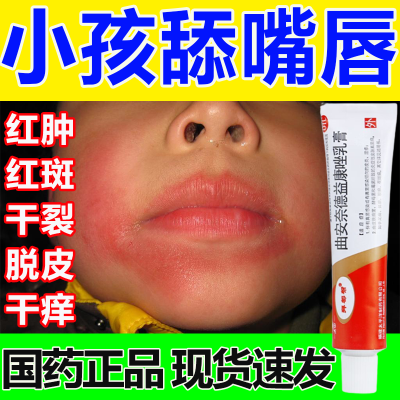 唇炎专用otc药慢性唇炎嘴唇干裂红肿瘙痒嘴角溃烂口角炎小孩舔嘴唇羊