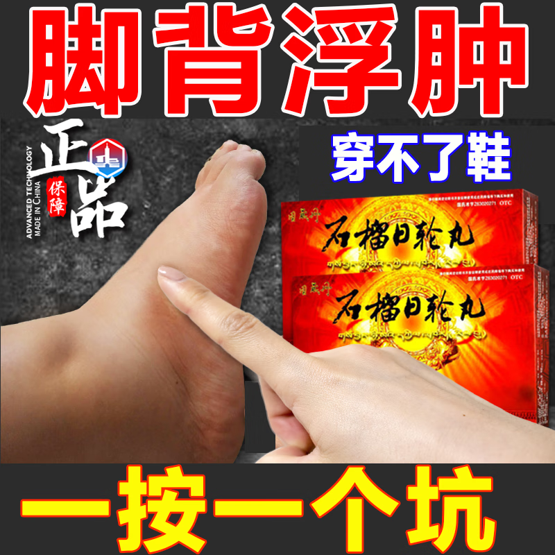 石榴日轮丸 利尿消肿 浮肿吃什么药消除水肿老年人下肢水肿浮肿脚背肿