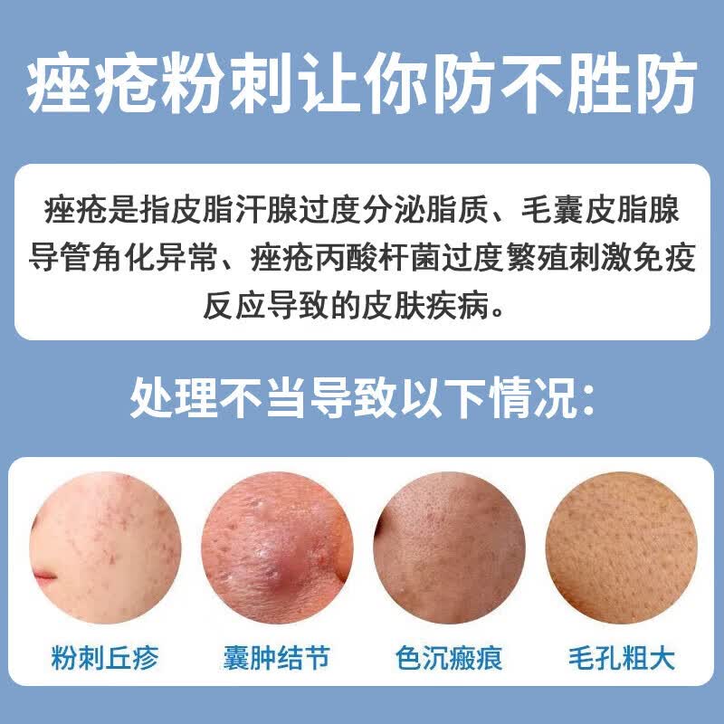 北京同仁堂 痤疮膏重度暗疮男女初中生腮边青春痘脸上额头下巴起小疙瘩痤疮膏专用痤疮凝胶 三盒装【买2送1】