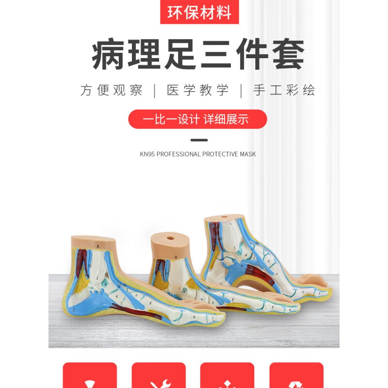 正常足 扁平足 弓型足 模型 足部病理模型人体足部肌肉解剖模型 弓形