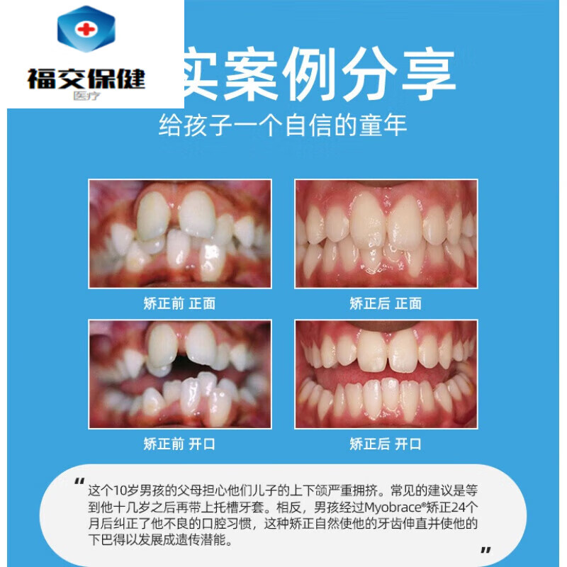 福交保健 澳洲进口myobrace儿童口肌功能训练器牙齿器mrc龅牙口呼吸k