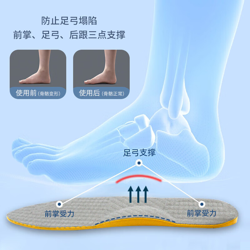 外八字走路矫正器成人o型腿矫正鞋垫成人儿童x形神器走路姿势矫正器外