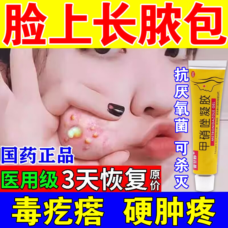 药膏祛痘消炎痤疮专用痤疮膏 祛痘 脓疱疮 毛囊炎皮脂腺囊肿疙瘩脓包