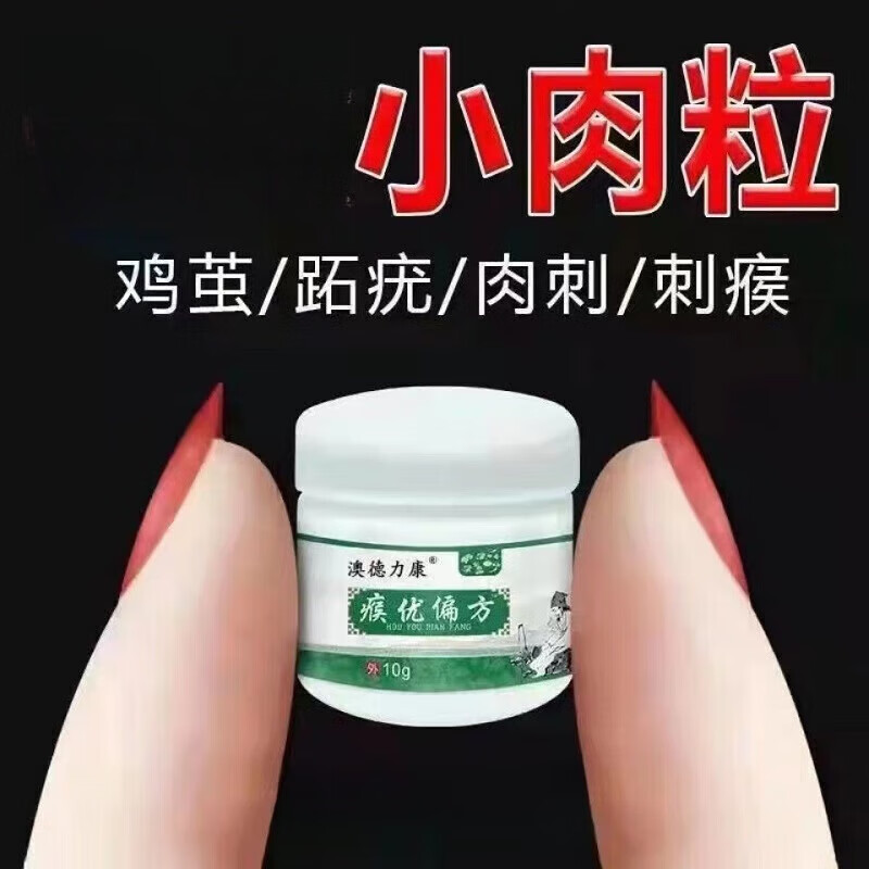 痣疣克星去除尤疣瘊猴子瘊子祛除神器肉粒疙瘩一抹忧无脖子上长小肉粒