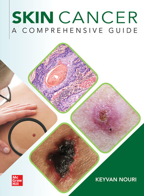 预订 skin cancer: a comprehensive guide