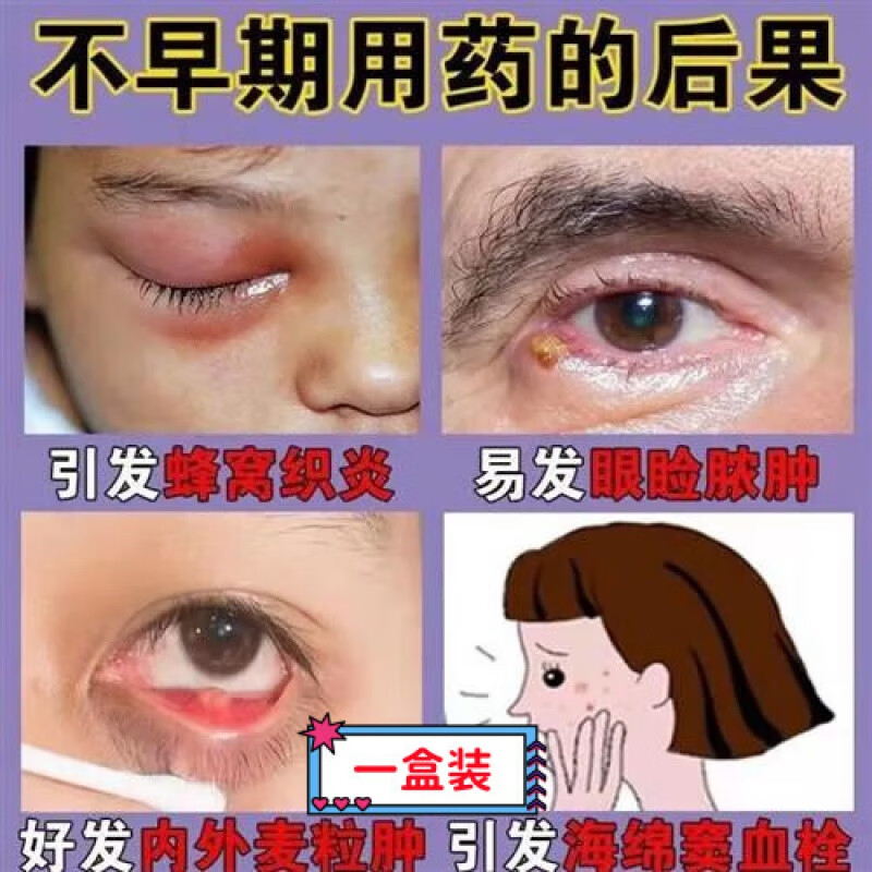 睑板腺堵塞疏通器眼膜疏通神器消除麦粒肿睑板腺囊肿堵塞眼皮红肿