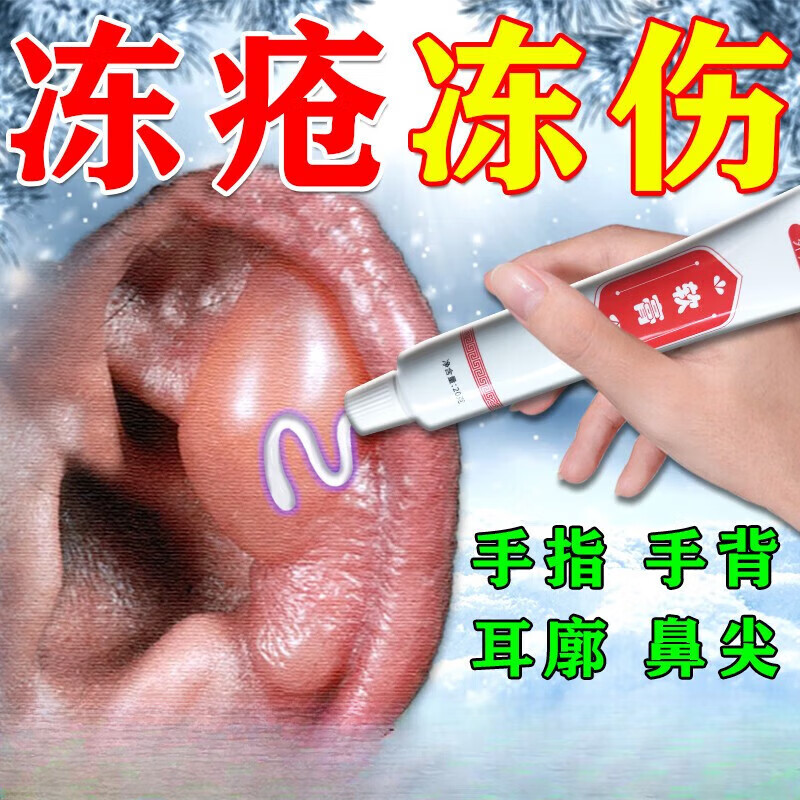 好物冻疮膏适用于手足皲裂足跟皲裂膏肿大瘙痒手裂愈合膏耳朵防冻伤