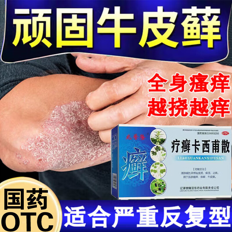 牛皮癣专用药膏顽固牛皮癣银屑病真菌止痒 抑菌 皮肤特治牛皮癣医用手
