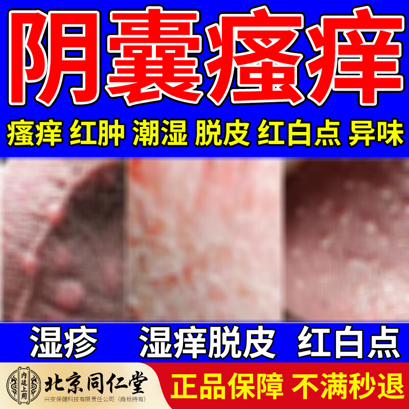 北京同仁堂 阴囊瘙痒湿疹私处睾丸痒去潮湿男人专用出汗起疹子红肿睾丸有异味湿热股癣大腿内测喷雾 一瓶装【30ml/瓶】