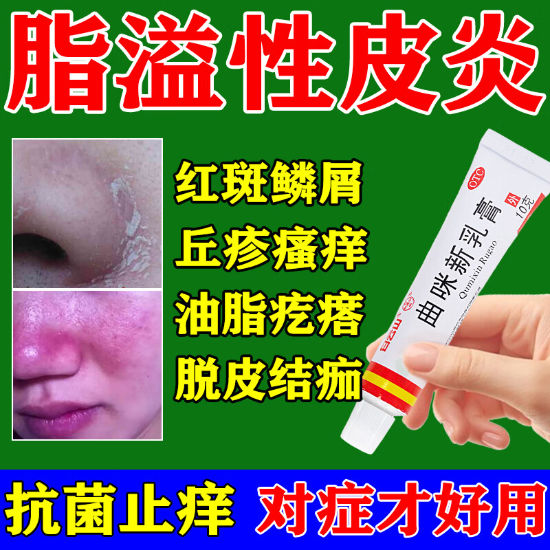 脂溢性皮炎专用药膏 面部脸部鼻子头皮痒有疙瘩发红 油脂旺盛下巴红肿