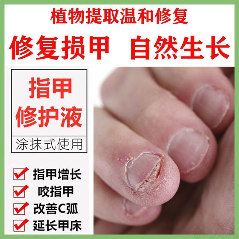 指甲生长水快速增长液养指甲变厚变硬修复液受损再生脚趾甲床发黄 20g
