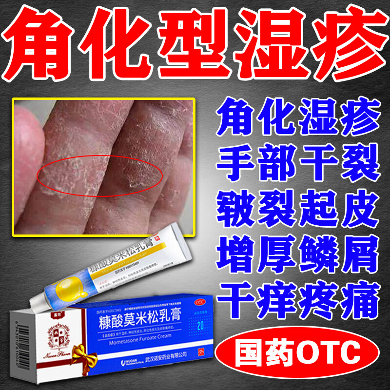 皮肤瘙痒手干裂干燥皮肤瘙痒 糠酸莫米松乳膏 1盒装【角质化湿疹】