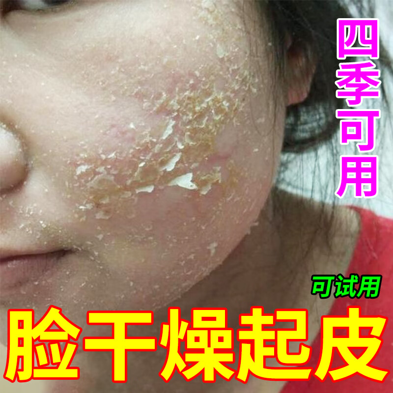脸上起皮干燥 脸干皮肤干燥瘙痒长癣脱皮脸部过敏红痒起皮脱屑 下巴