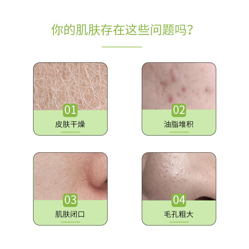 冰肤之萃芦荟胶300g/罐补水保湿舒缓修护