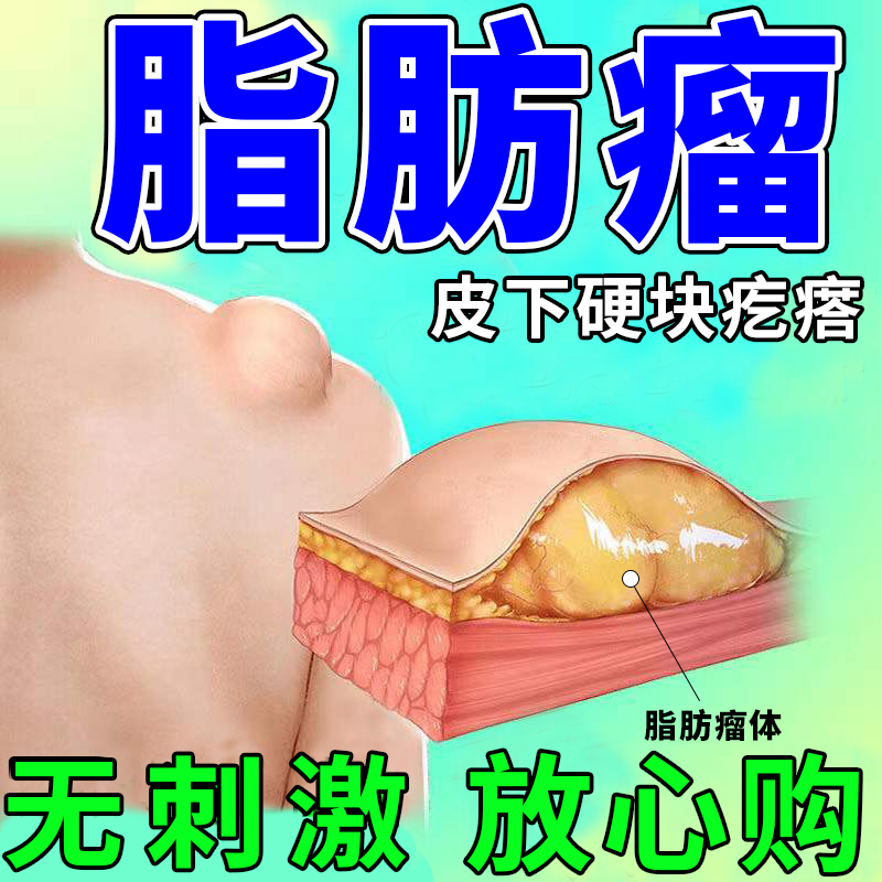 多发性脂神器减少硬块结节纤维瘤专用中草非药贴多发性脂肪瘤神i器 单