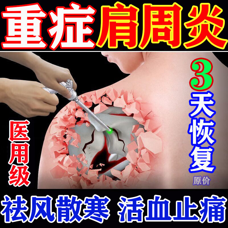 肩膀疼痛专用膏药 肩周炎疼痛膏药  肩周劳损抬不起胳膊 肩膀疼痛僵硬