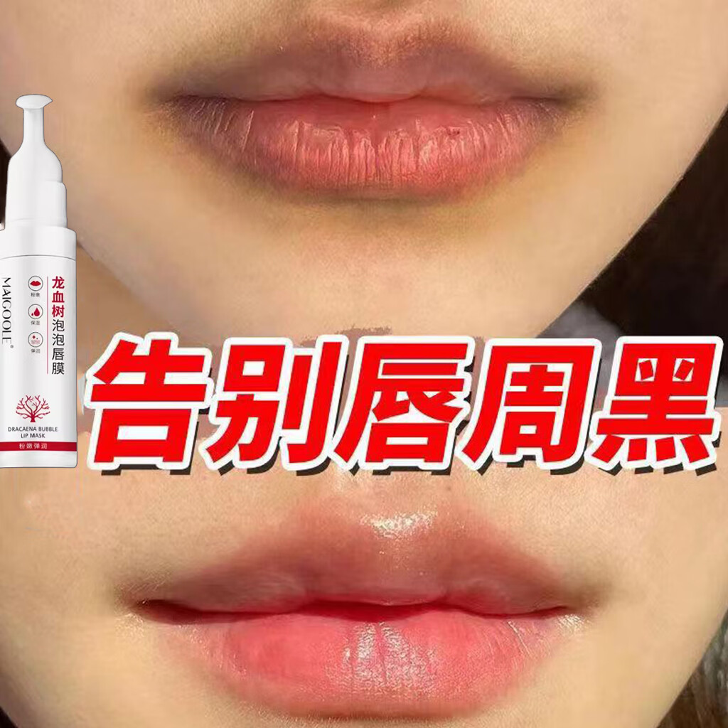 玫黛琳嘴角唇周去i纹黑色素发黑改善去除润唇膏唇周角黑嘴唇暗沉嘟嘟