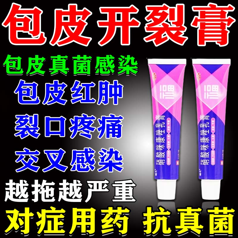发炎裂口红肿疼痛私处瘙痒流脓用什么药男性私处龟头炎硝酸咪康唑乳膏