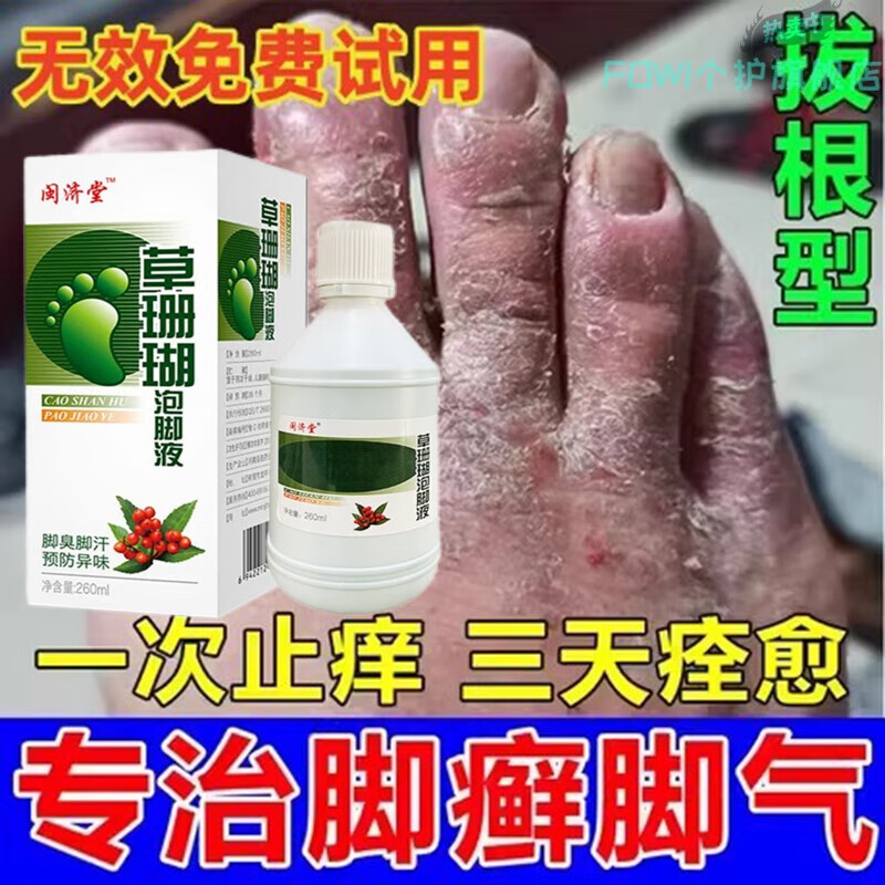 beiyvs脚癣一次净老牌子净泡脚液洗烂脚丫药脱皮糜烂脚趾旗舰正品 1