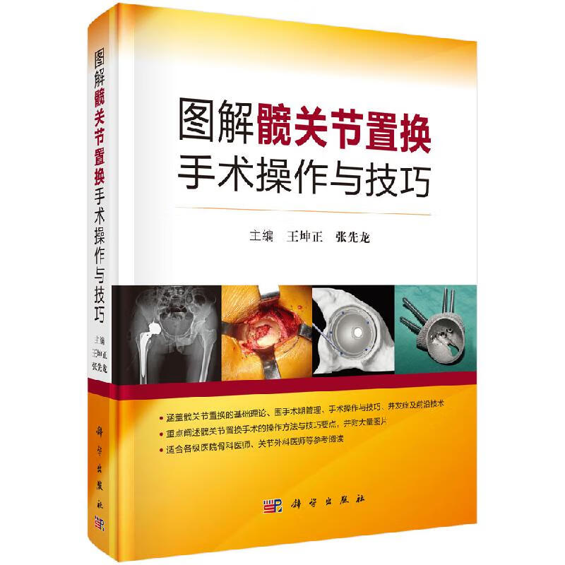 王坤正 张先龙 主编 人工股骨头置换术 髋关节表面置换术 外科手术骨