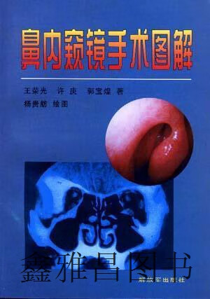 鼻内窥镜手术图解,王荣光等编著;杨贵舫绘,解放军出版社