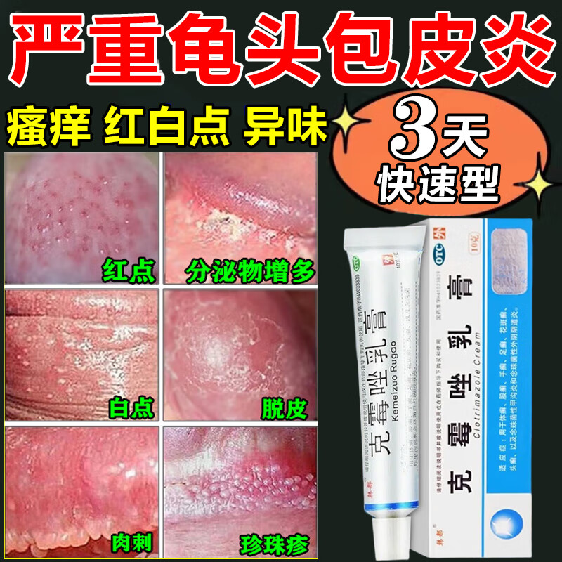 克霉唑乳膏 龟i头炎包皮炎专用药膏 治疗念珠菌性龟头炎的药药膏真菌