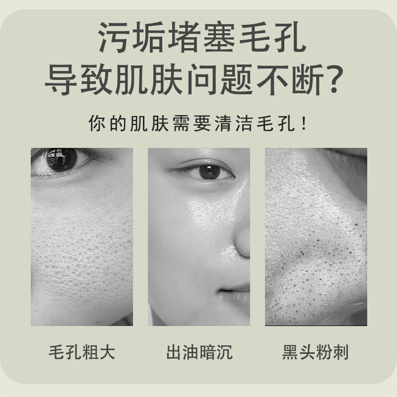 红卫香皂羊脂皂洗脸沐浴祛螨硫磺皂清洁去污渍不伤手肥皂男女儿童适用 羊脂皂 120g 5块 【赠起泡网】