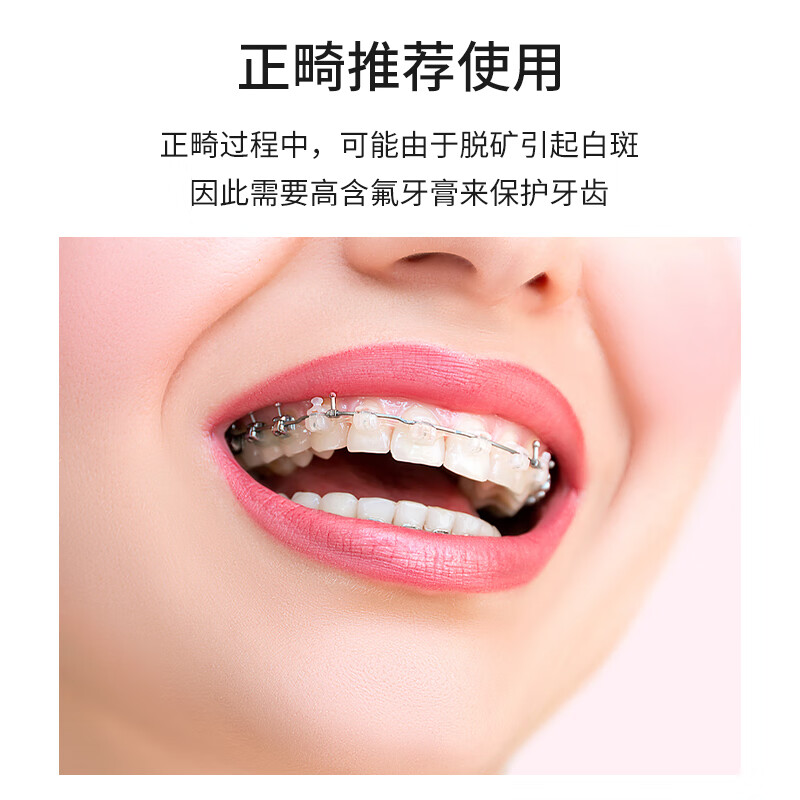 edel+white进口埃德尔正畸牙膏含氟成人青少年高氟防脱矿矫正牙套专用防蛀 正畸牙膏