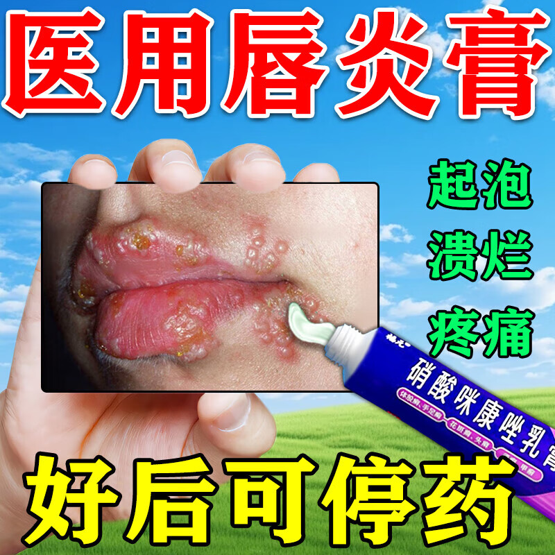 唇炎抹什么唇膏(唇炎抹什么唇膏好)