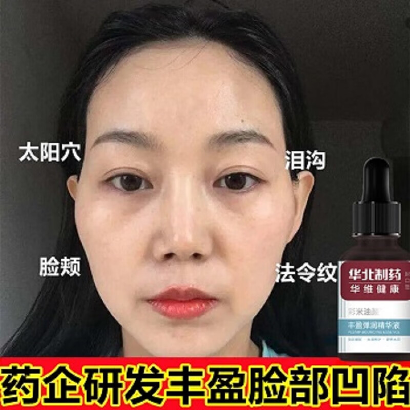 华北制药脸部填充凹陷丰脸颊额头太阳穴眼窝下巴去法令文泪沟饱满 单