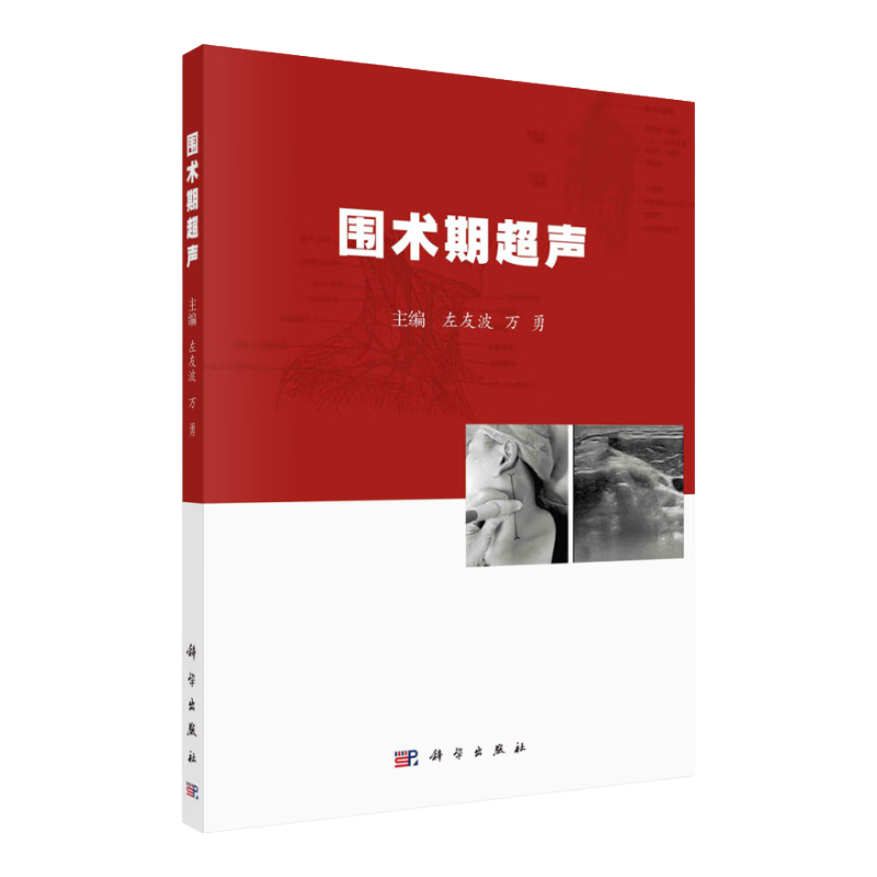 围术期超声  围术期超声基础 超声引导的上肢神经阻滞 胃部超声在围术期的应用 左友波 万勇编著  科学出版社