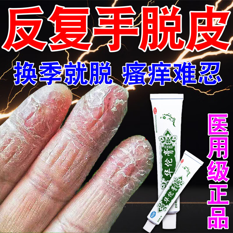 手脱皮用什么药真菌感染脱皮药膏严重脱皮蜕皮干燥起皮治手癣手皮开裂