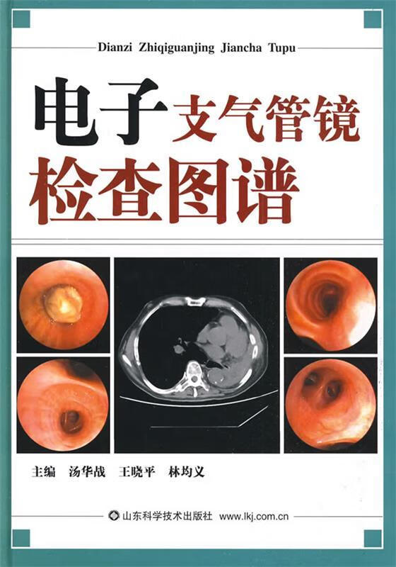 电子支气管镜检查图谱 9787533152062 汤华战,王晓平,林均义 主编