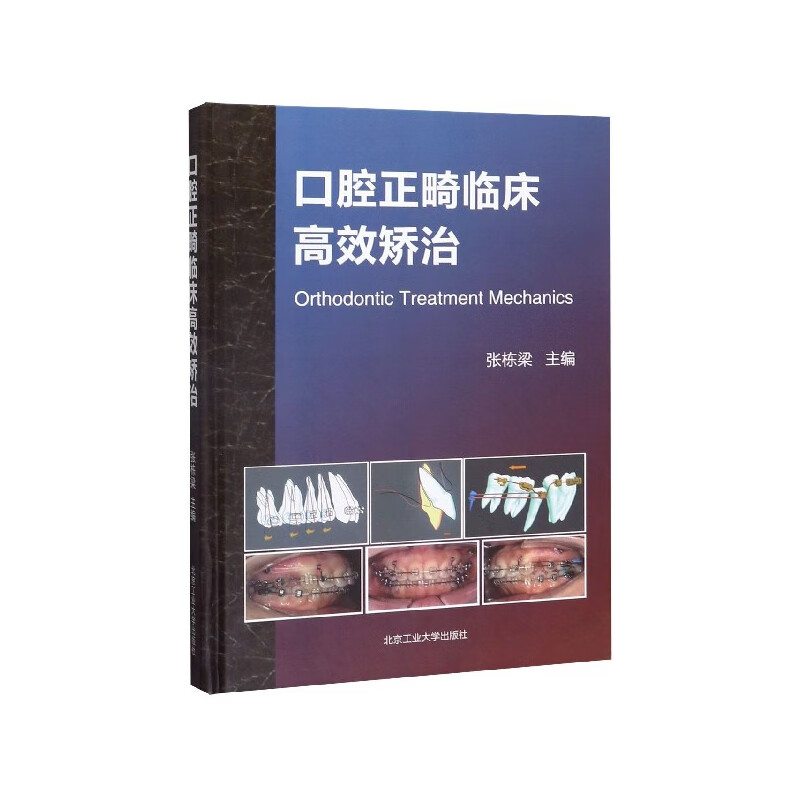 官方正版口腔正畸临床矫治(精)编者:张栋梁|责编:马红治9787563969180