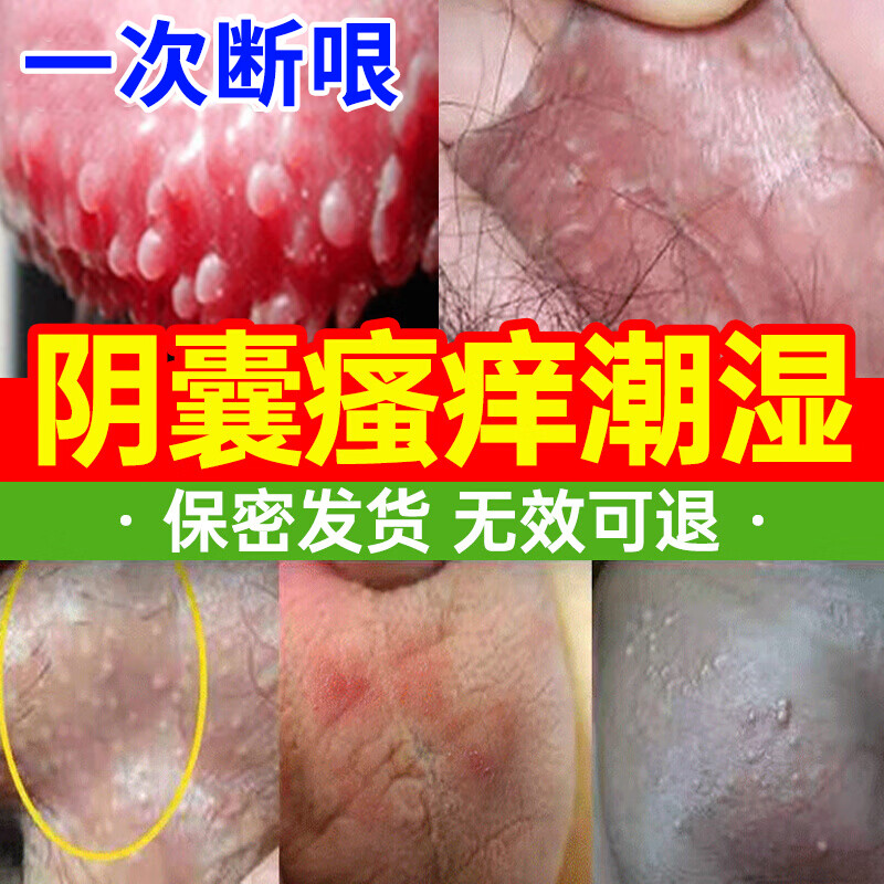i根阴囊湿痒疹潮湿红肿异味专用膏i药 三盒装【买3送2】阴囊脱皮红肿