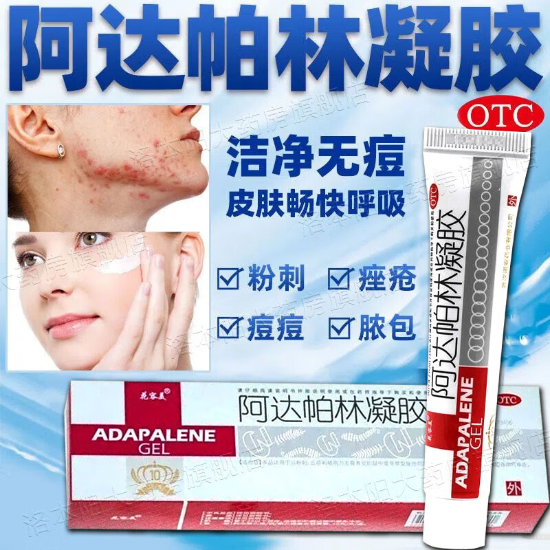 阿达帕林凝胶维a酸祛痘药膏治痘痘的药去粉刺痤疮闭口粉刺黑头面部