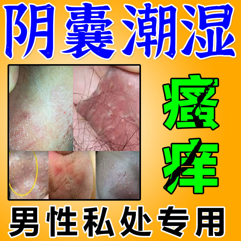 阴囊潮湿瘙痒男人专用止痒男性蛋蛋出汗有异味阴囊湿疹长痘大腿内侧