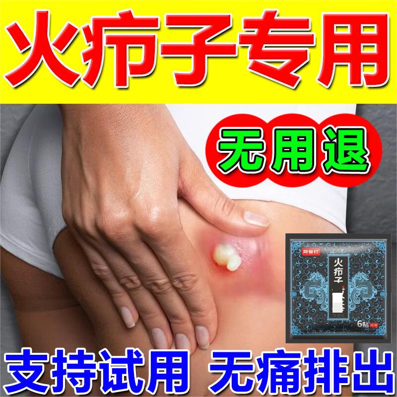 火疖子消毒贴黑膏贴疖子脓包拔拔脓膏消毒贴软膏痘痘坐板疮拨脓膏 一