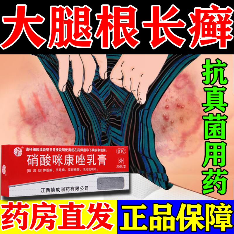 股癣藓大腿内侧 真菌感染大腿内侧瘙痒红疹 股癣皮肤癣抗真菌药膏皮肤