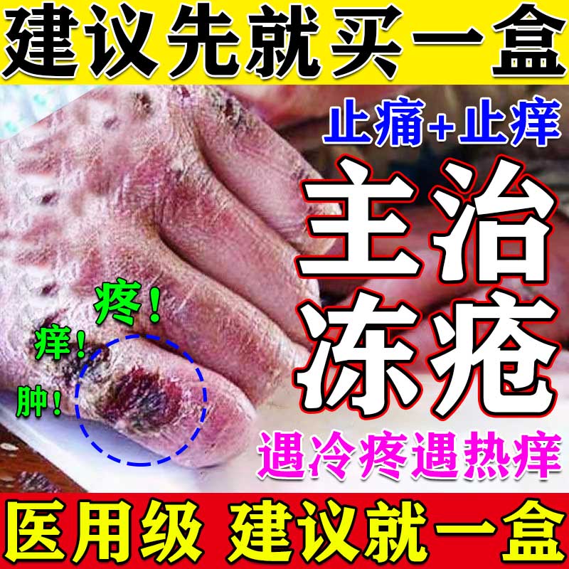 主治冻疮止痛止痒 皮肤用药非处方药 冻疮膏 10g 2盒